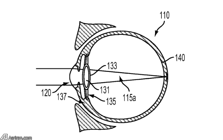 گوگل در اندیشه ایجاد چشم بیونیک